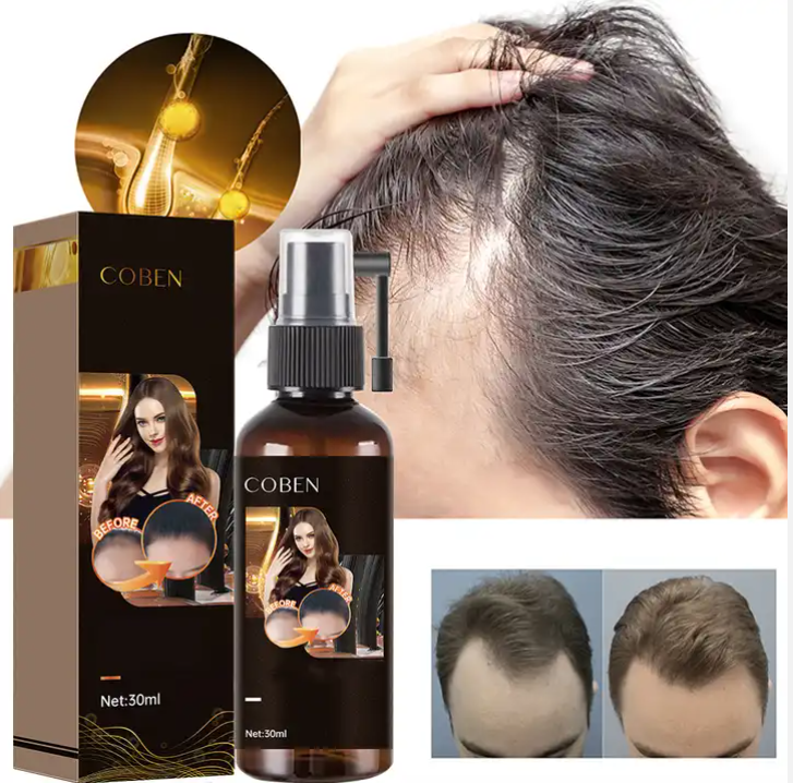 SER ANTICADERE PAR CU 5% MINOXIDIL, BIOTINA SI GHIMBIR
