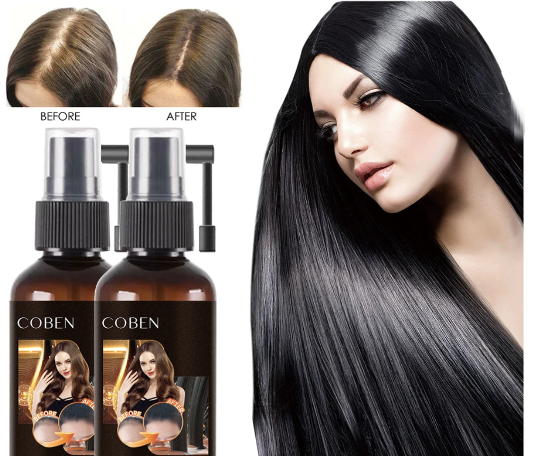 SER ANTICADERE PAR CU 5% MINOXIDIL, BIOTINA SI GHIMBIR