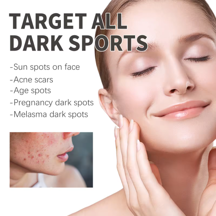 CREMA LĂPTOASĂ HIDRATANTĂ DE FAȚĂ PENTRU REPARAREA URMELOR ACNEICE 30ML