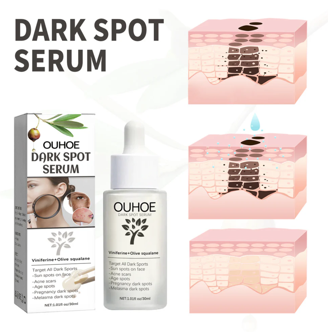 CREMA LĂPTOASĂ HIDRATANTĂ DE FAȚĂ PENTRU REPARAREA URMELOR ACNEICE 30ML