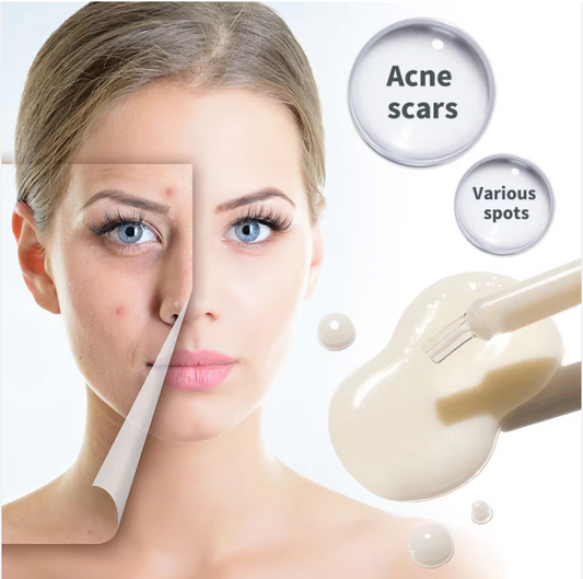 CREMA LĂPTOASĂ HIDRATANTĂ DE FAȚĂ PENTRU REPARAREA URMELOR ACNEICE 30ML